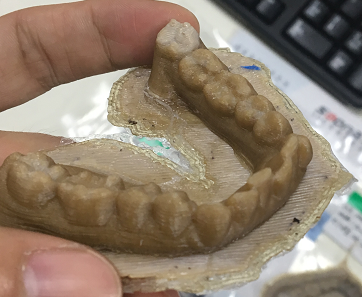 打印牙齒模型